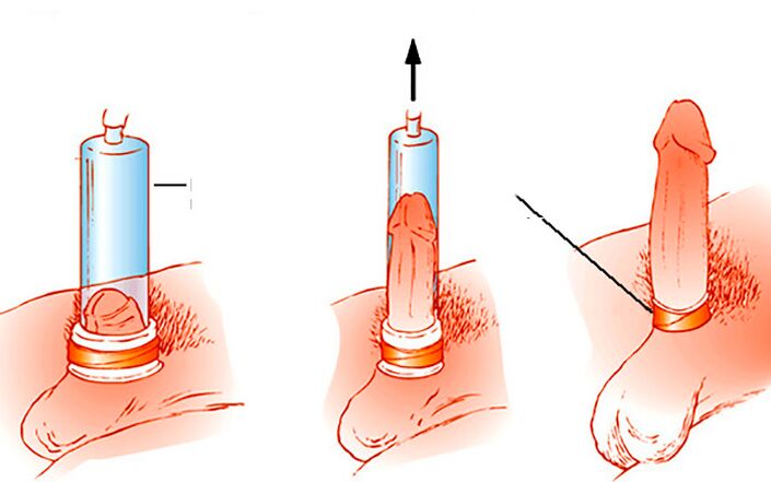 Comment fonctionne la pompe