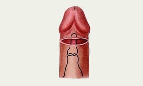 gland